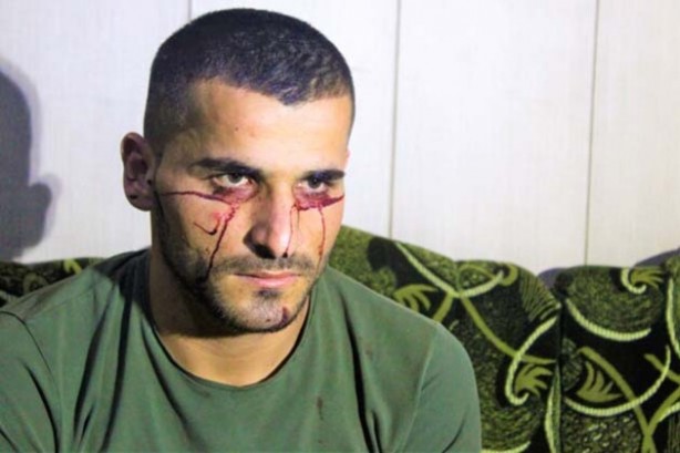 "Kan ağlayan" Iraklı genç, Türkiye'den yardım bekliyor