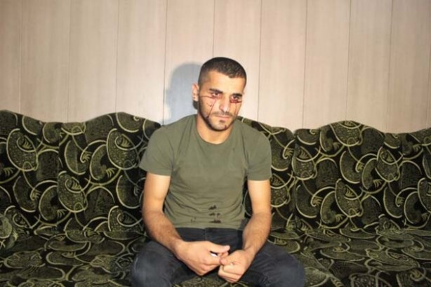 "Kan ağlayan" Iraklı genç, Türkiye'den yardım bekliyor
