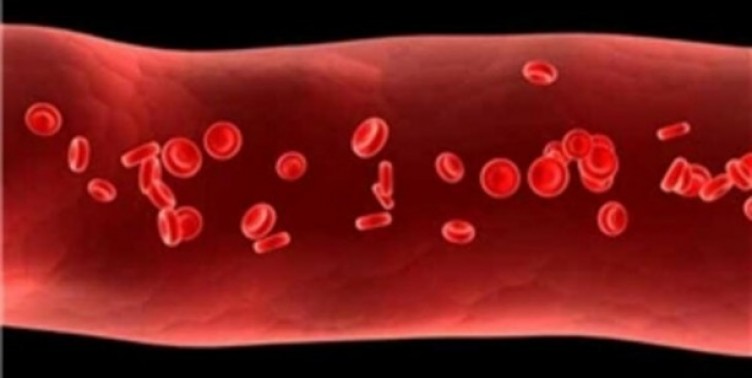 Kan damarlarındaki tıkanıklıkları açmak için yeni yöntem