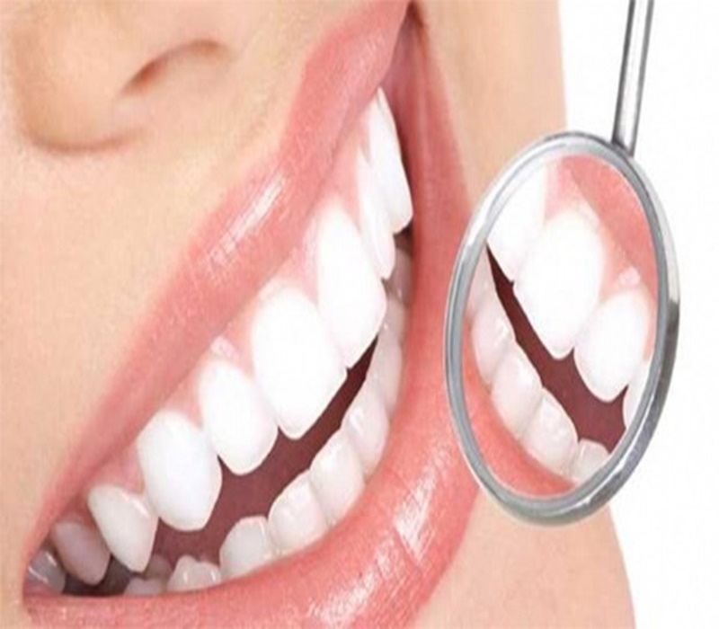 Diş iltihabı nasıl geçer? Diş eti şişmesine ne iyi gelir? Sağlık