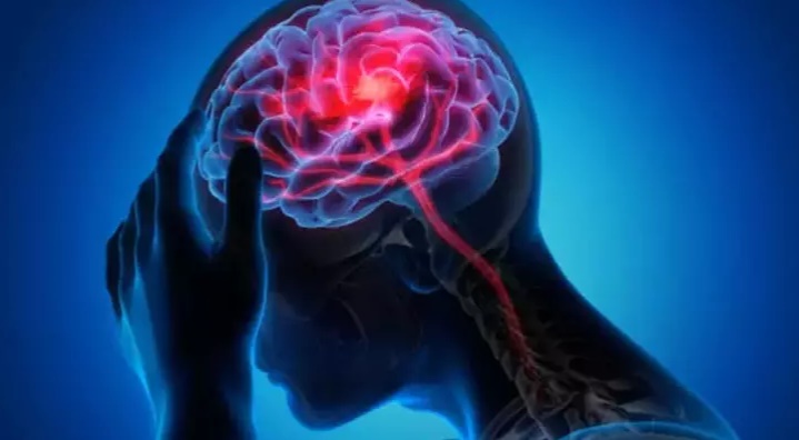 Uykusuzluk, beyinde tehlikeli toksinlerin birikmesine yol açabilir