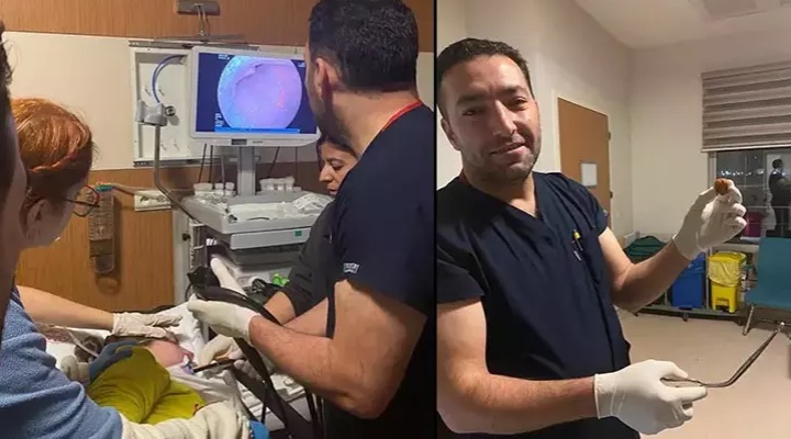 Zihinsel engelli kadının yemek borusuna kaçan ceviz, operasyonla çıkarıldı