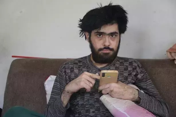 Türkiye'nin gündemine oturmuştu: Telefon bağımlısı genç, 3 yıl sonra duş aldı