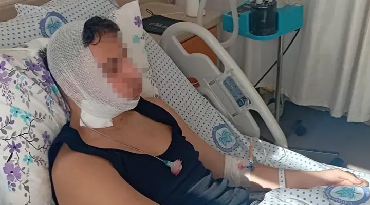 Lise öğrencilerinin darp davası: Çenesi nasıl kırıldı anlam veremedik